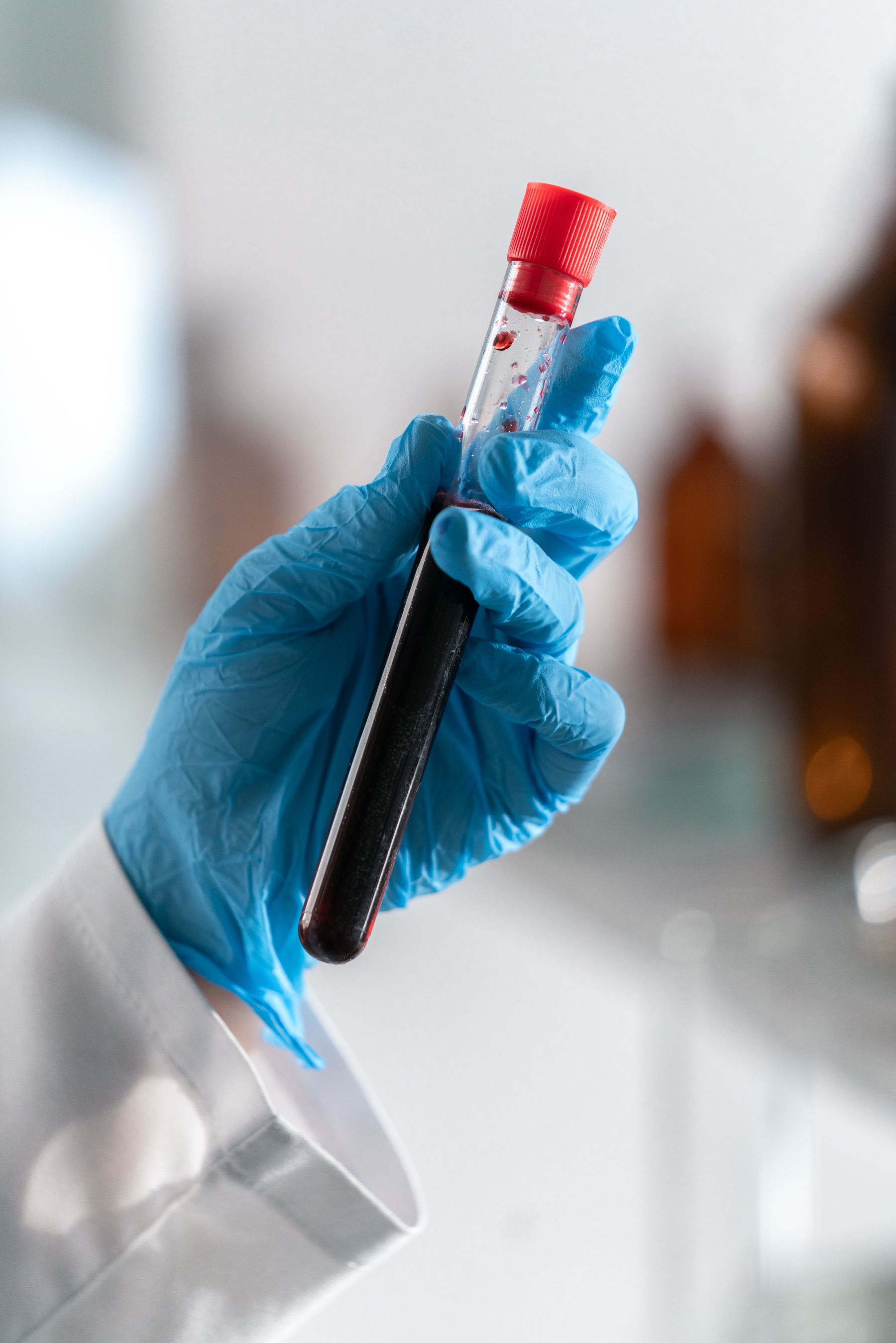 Profissional de laboratório segurando um tubo de exame